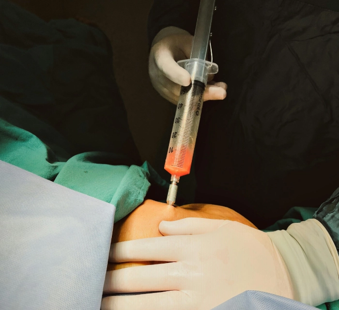 A medical professional administers an injection into a patient's knee using a syringe filled with reddish fluid. The scene is part of a medical procedure with gloved hands visible.