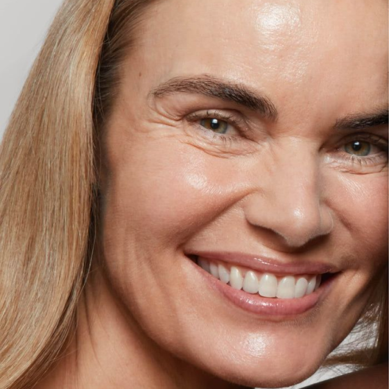 Lines & Wrinkles Featured Image