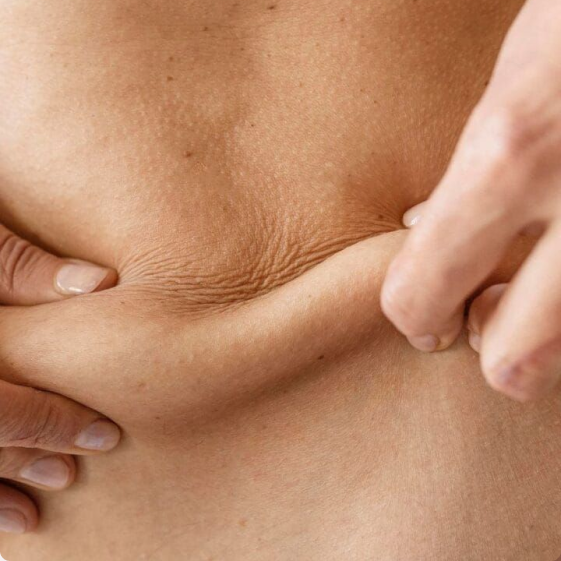 Loose Skin Featured Image